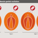 FGM_types_